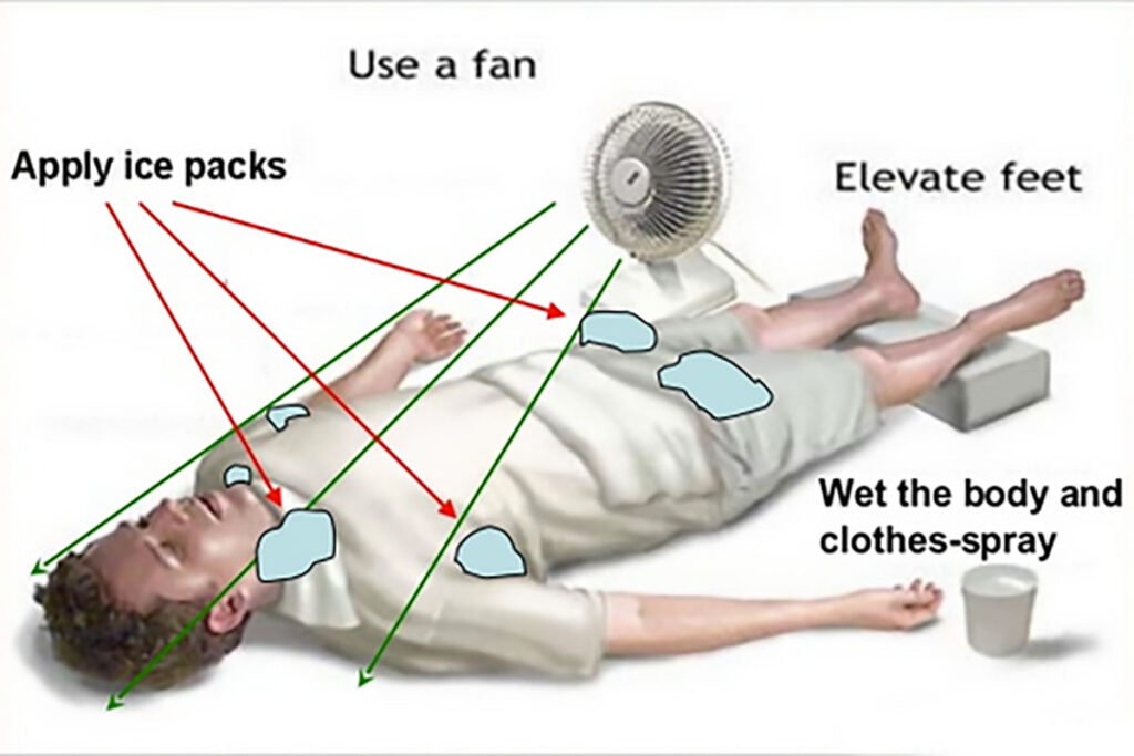 Evaporative cooling is an effective method that can be achieved by undressing, then moistening the individual with water and generating air movement over their body to facilitate the cooling process. Source: emdocs.net